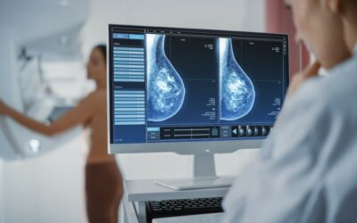 Mammographie dépistage cancer du sein